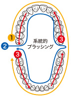 系統的ブラッシング