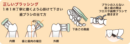 正しいブラッシング